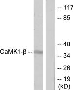 PNCK Antibody in Western Blot (WB)