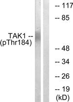 Phospho-TAK1 (Thr184) Antibody in Western Blot (WB)