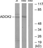 ADCK2 Antibody in Western Blot (WB)