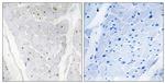 ALPK2 Antibody in Immunohistochemistry (Paraffin) (IHC (P))
