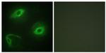 LATH Antibody in Immunocytochemistry (ICC/IF)