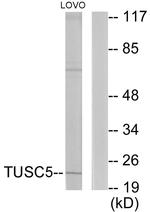 TUSC5 Antibody in Western Blot (WB)