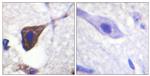 Phospho-beta-2 Adrenergic Receptor (Ser346) Antibody in Immunohistochemistry (Paraffin) (IHC (P))