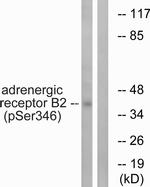 Phospho-beta-2 Adrenergic Receptor (Ser346) Antibody in Western Blot (WB)