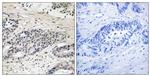Phospho-Aurora A (Ser342) Antibody in Immunohistochemistry (Paraffin) (IHC (P))