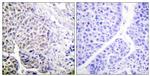 Phospho-Aurora B (Tyr12) Antibody in Immunohistochemistry (Paraffin) (IHC (P))