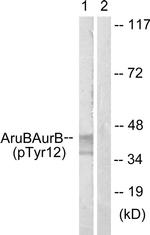Phospho-Aurora B (Tyr12) Antibody in Western Blot (WB)
