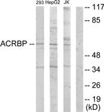 ACRBP Antibody in Western Blot (WB)