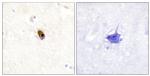 Phospho-Aurora C (Thr236, Thr202) Antibody in Immunohistochemistry (Paraffin) (IHC (P))
