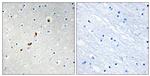 ZNF596 Antibody in Immunohistochemistry (Paraffin) (IHC (P))
