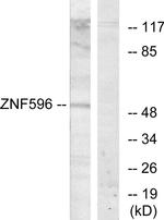ZNF596 Antibody in Western Blot (WB)