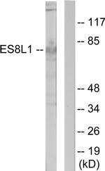 EPS8L1 Antibody in Western Blot (WB)