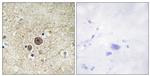 Phospho-alpha Catenin (Ser641) Antibody in Immunohistochemistry (Paraffin) (IHC (P))