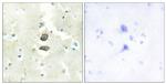 BRI3BP Antibody in Immunohistochemistry (Paraffin) (IHC (P))