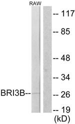 BRI3BP Antibody in Western Blot (WB)
