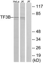 BRF1 Antibody in Western Blot (WB)