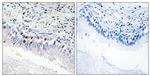 MED12 Antibody in Immunohistochemistry (Paraffin) (IHC (P))