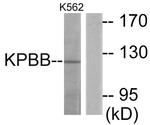 PHKB Antibody in Western Blot (WB)