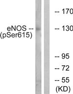 Phospho-eNOS (Ser615) Antibody in Western Blot (WB)