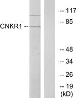 CNKSR1 Antibody in Western Blot (WB)