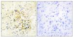 PMEPA1 Antibody in Immunohistochemistry (Paraffin) (IHC (P))