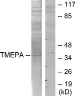 PMEPA1 Antibody in Western Blot (WB)