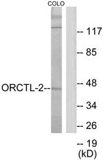 SLC22A18 Antibody in Western Blot (WB)