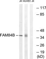 FAM84B Antibody in Western Blot (WB)
