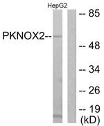 PKNOX2 Antibody in Western Blot (WB)