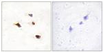 IP6K3 Antibody in Immunohistochemistry (Paraffin) (IHC (P))