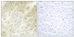 ARHGEF17 Antibody in Immunohistochemistry (Paraffin) (IHC (P))