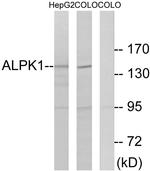 ALPK1 Antibody in Western Blot (WB)