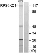 RPS6KC1 Antibody in Western Blot (WB)