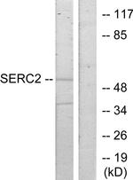 SERC2 Antibody in Western Blot (WB)
