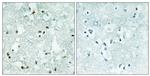 ELAC2 Antibody in Immunohistochemistry (Paraffin) (IHC (P))
