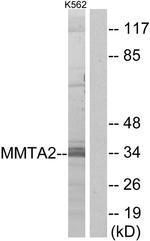 MMTAG2 Antibody in Western Blot (WB)