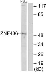 ZNF436 Antibody in Western Blot (WB)