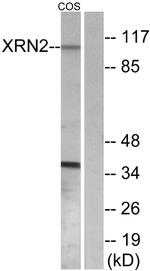 XRN2 Antibody in Western Blot (WB)