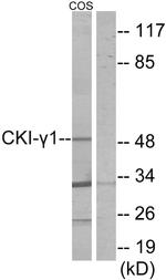 CK1 gamma-1 Antibody in Western Blot (WB)