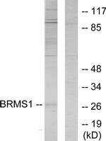 BRMS1 Antibody in Western Blot (WB)