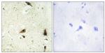 CHRAC1 Antibody in Immunohistochemistry (Paraffin) (IHC (P))