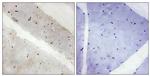 LATS2 Antibody in Immunohistochemistry (Paraffin) (IHC (P))