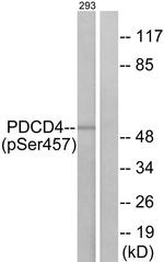 Phospho-PDCD4 (Ser457) Antibody in Western Blot (WB)