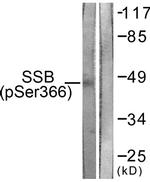 Phospho-SSB (Ser366) Antibody in Western Blot (WB)