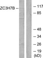 ZC3H7B Antibody in Western Blot (WB)