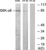 RSK4 Antibody in Western Blot (WB)