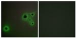CRSP130 Antibody in Immunocytochemistry (ICC/IF)