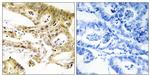 CRSP130 Antibody in Immunohistochemistry (Paraffin) (IHC (P))