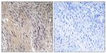 Phospho-RhoGDI (Ser174) Antibody in Immunohistochemistry (Paraffin) (IHC (P))
