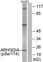 Phospho-RhoGDI (Ser174) Antibody in Western Blot (WB)